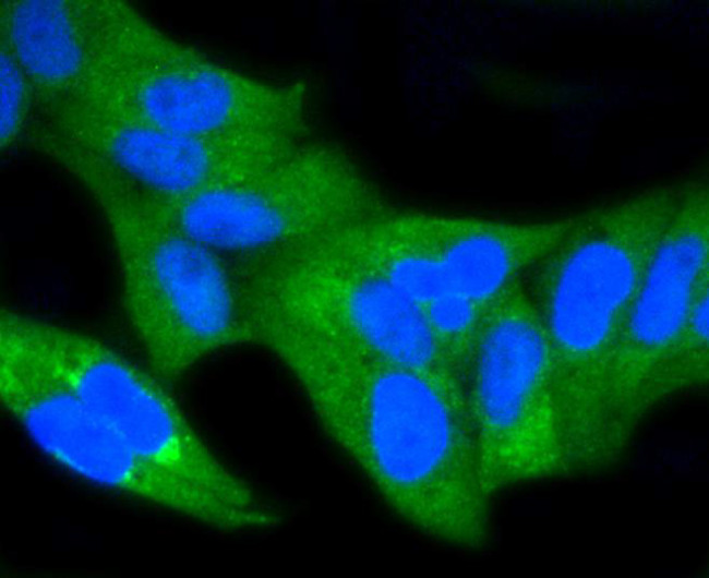 NFkB p65 Antibody in Immunocytochemistry (ICC/IF)