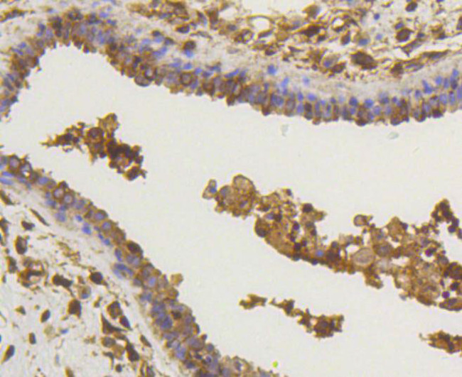 NFkB p65 Antibody in Immunohistochemistry (Paraffin) (IHC (P))