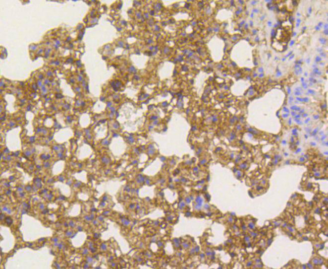 NFkB p65 Antibody in Immunohistochemistry (Paraffin) (IHC (P))