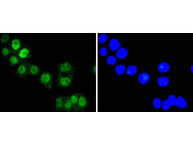 FOXO3A Antibody in Immunocytochemistry (ICC/IF)