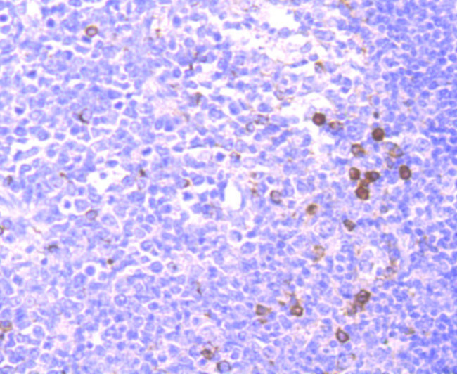 CD137 (4-1BB) Antibody in Immunohistochemistry (Paraffin) (IHC (P))