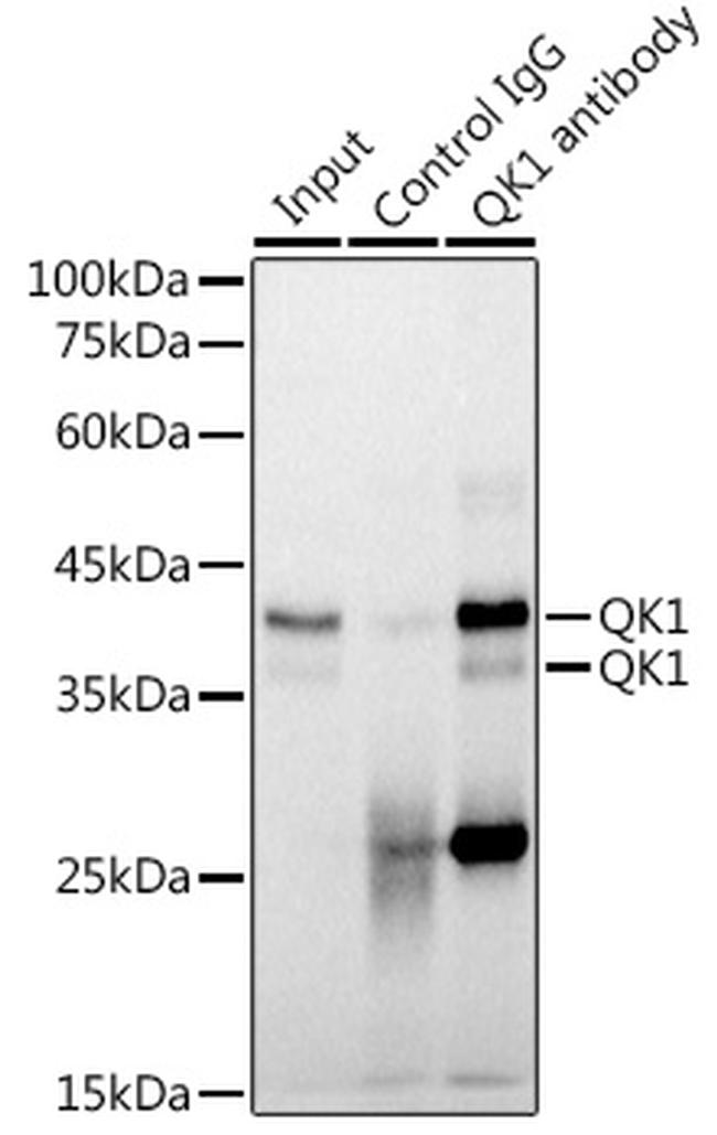 QKI Recombinant Monoclonal Antibody (1D1N6) (MA5-42589)