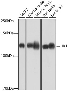 HK1 Antibody in Western Blot (WB)