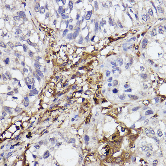 GBP1 Antibody in Immunohistochemistry (Paraffin) (IHC (P))