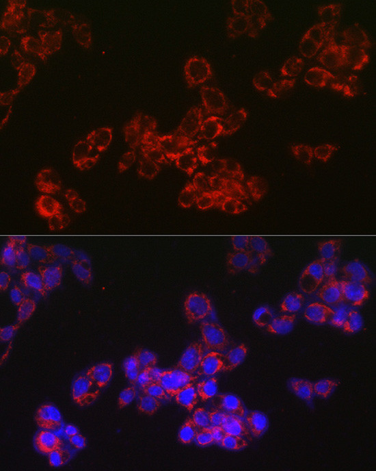 ACAA2 Antibody in Immunocytochemistry (ICC/IF)