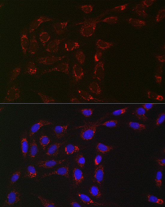 ACAA2 Antibody in Immunocytochemistry (ICC/IF)