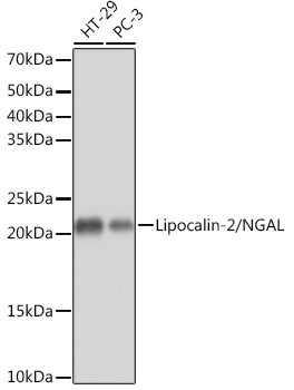 NGAL Antibody in Western Blot (WB)