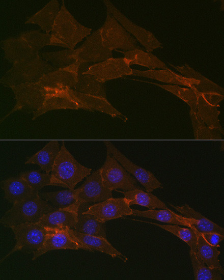 Sodium Potassium ATPase Antibody in Immunocytochemistry (ICC/IF)