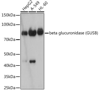 GUSB Antibody in Western Blot (WB)