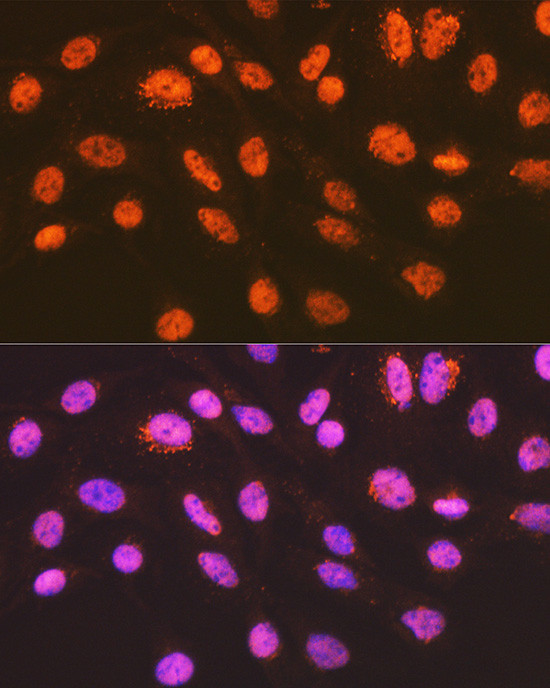 ENT2 Antibody in Immunocytochemistry (ICC/IF)