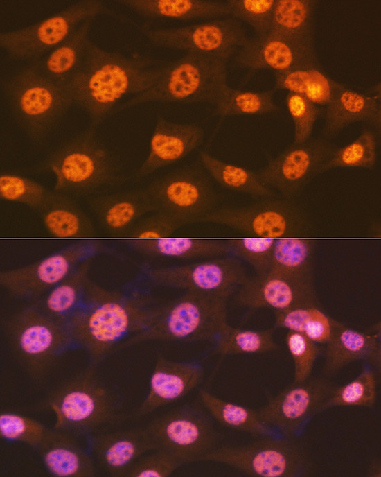 ENT2 Antibody in Immunocytochemistry (ICC/IF)