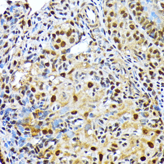 ENT2 Antibody in Immunohistochemistry (Paraffin) (IHC (P))