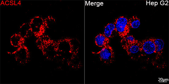 ACSL4 Antibody in Immunocytochemistry (ICC/IF)