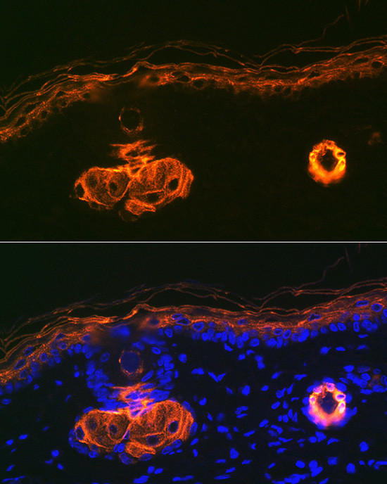 ApoC3 Antibody in Immunohistochemistry (Paraffin) (IHC (P))