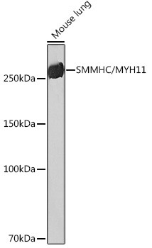 MYH11 Antibody in Western Blot (WB)