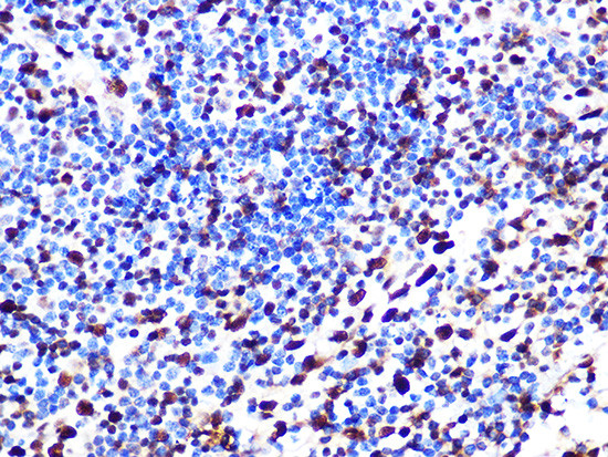 SAMHD1 Antibody in Immunohistochemistry (Paraffin) (IHC (P))