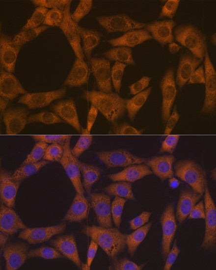 CAD Antibody in Immunocytochemistry (ICC/IF)