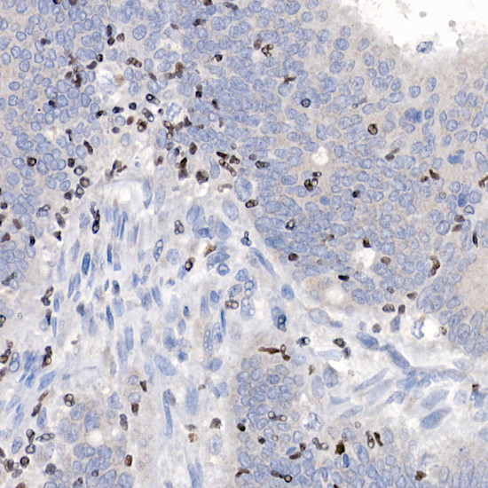 IKZF3 Antibody in Immunohistochemistry (Paraffin) (IHC (P))