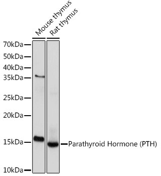 PTH Antibody in Western Blot (WB)