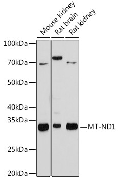 MT-ND1 Antibody in Western Blot (WB)