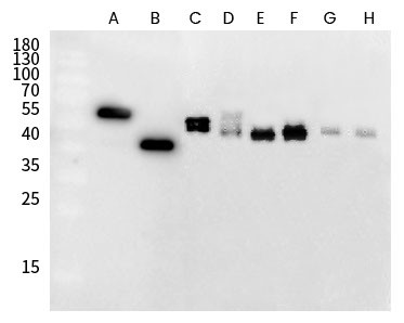 RSV Fusion Protein Antibody in Western Blot (WB)