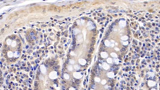 RARS Antibody in Immunohistochemistry (Paraffin) (IHC (P))