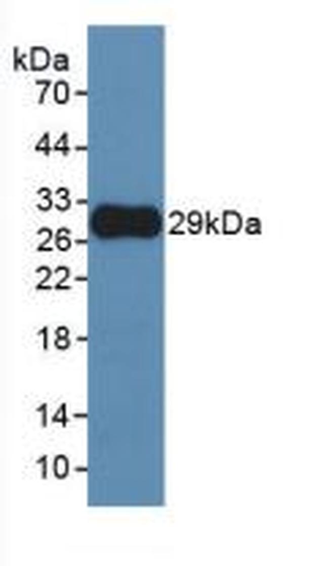 MMP25 Antibody in Western Blot (WB)