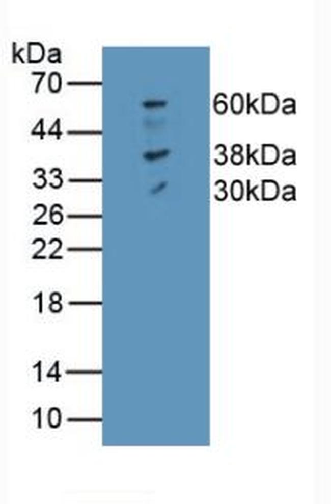 Ferroportin Antibody in Western Blot (WB)