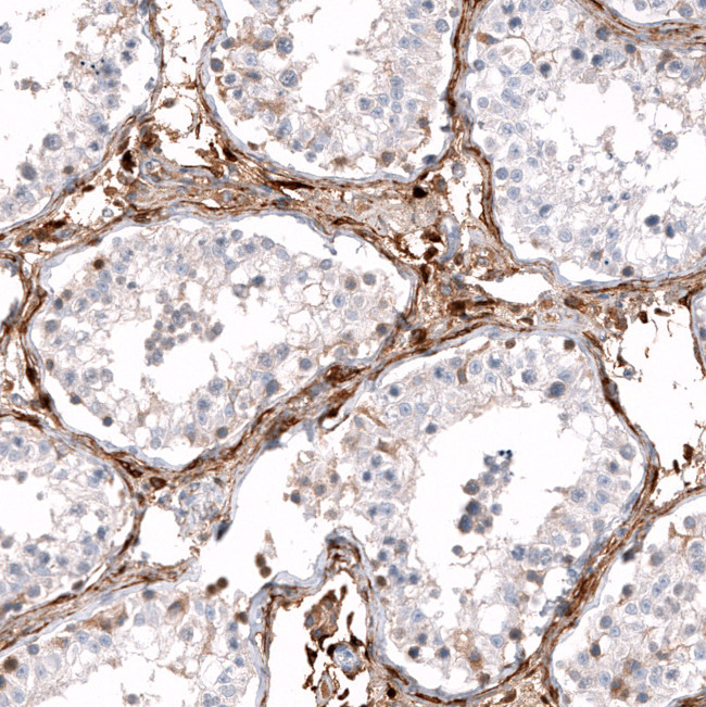 ALDH1A3 Antibody in Immunohistochemistry (Paraffin) (IHC (P))