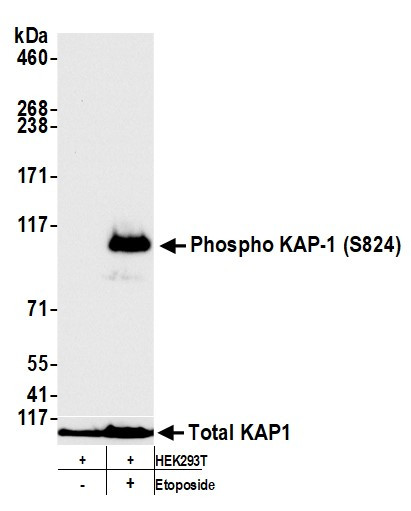 Phospho-TRIM28 (Ser824) Antibody in Western Blot (WB)