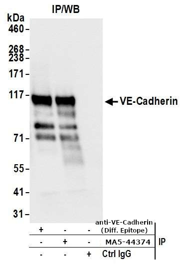 CD144 (VE-cadherin) Antibody in Immunoprecipitation (IP)
