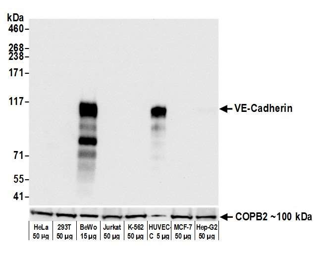 CD144 (VE-cadherin) Antibody in Western Blot (WB)