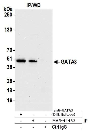 GATA3 Antibody in Immunoprecipitation (IP)