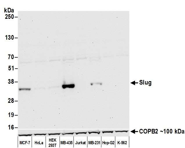 SLUG Antibody in Western Blot (WB)