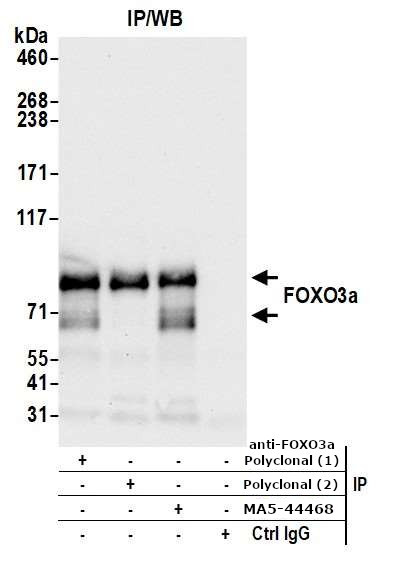 FOXO3A Antibody in Immunoprecipitation (IP)