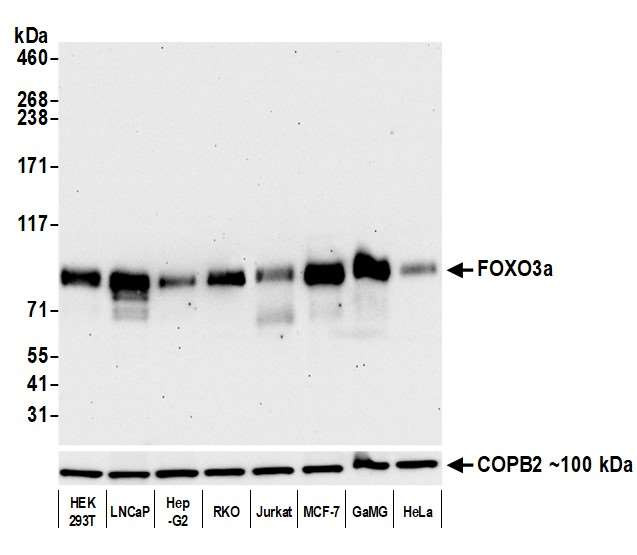 FOXO3A Antibody in Western Blot (WB)