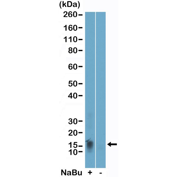 H2BK11ac Antibody in Western Blot (WB)