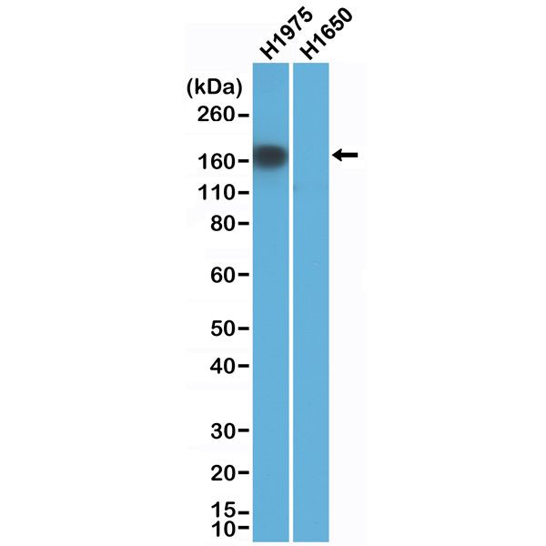 EGFR L858R Antibody in Western Blot (WB)