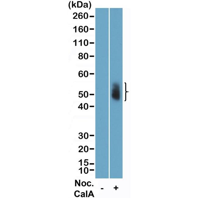 Phospho-Aurora A/B/C (Thr288, Thr232, Thr198) Recombinant Monoclonal ...