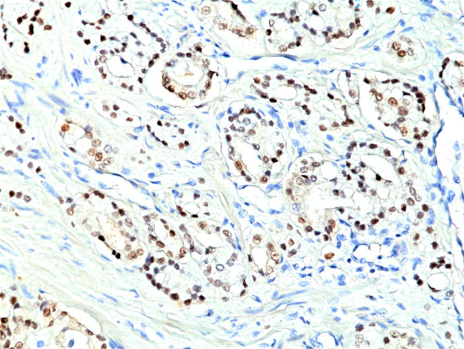 Nkx3.1 Antibody in Immunohistochemistry (Paraffin) (IHC (P))