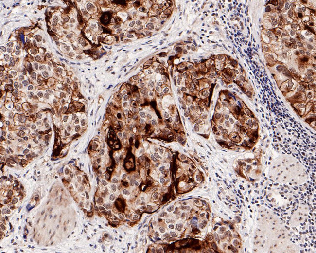 UPK3A Antibody in Immunohistochemistry (Paraffin) (IHC (P))