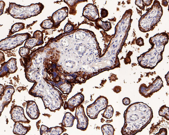 Placental Alkaline Phosphatase Antibody in Immunohistochemistry (Paraffin) (IHC (P))