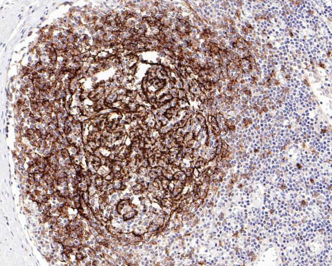 CD23 Antibody in Immunohistochemistry (Paraffin) (IHC (P))