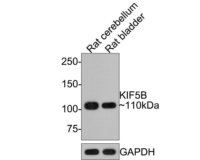 Kinesin 5B Antibody in Western Blot (WB)