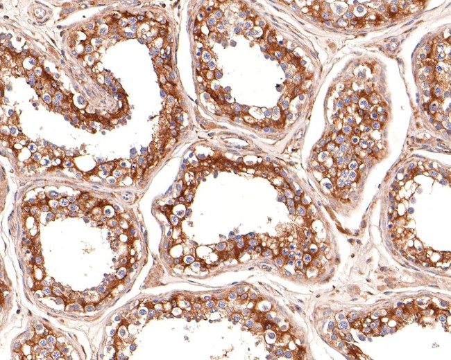 TRIP10 Antibody in Immunohistochemistry (Paraffin) (IHC (P))