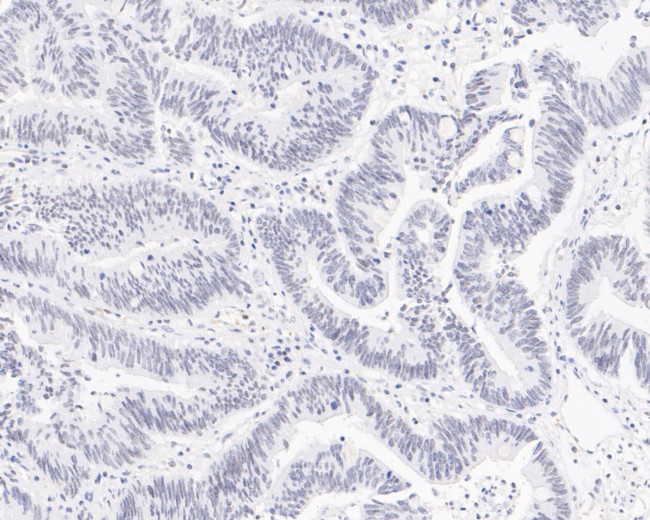 PIAS1 Antibody in Immunohistochemistry (Paraffin) (IHC (P))