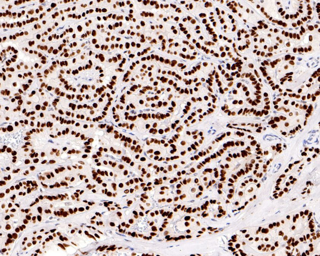 Nkx2.1 Antibody in Immunohistochemistry (Paraffin) (IHC (P))