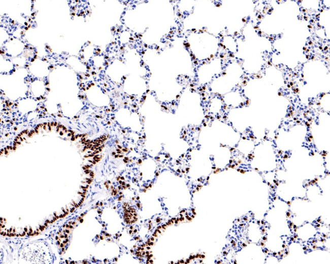 Nkx2.1 Antibody in Immunohistochemistry (Paraffin) (IHC (P))