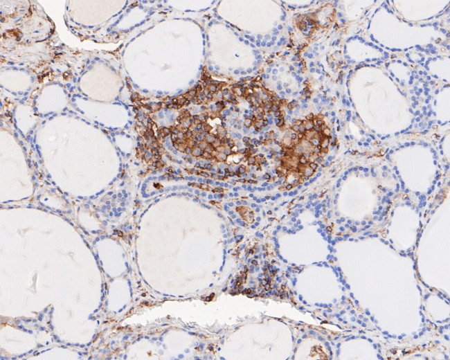 ARPC2 Antibody in Immunohistochemistry (Paraffin) (IHC (P))