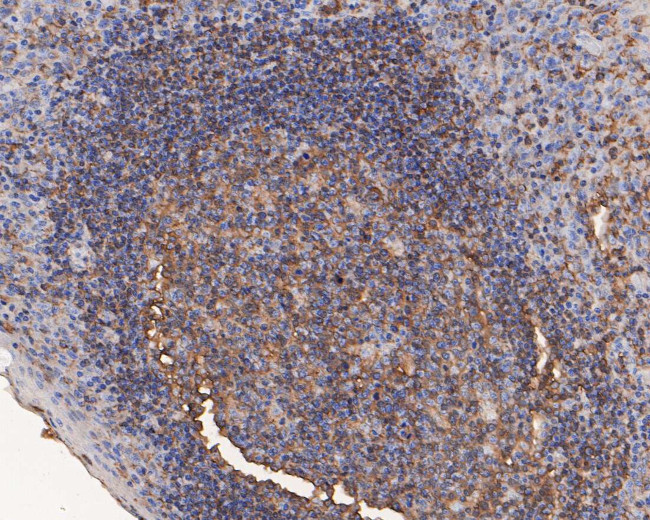 ARPC2 Antibody in Immunohistochemistry (Paraffin) (IHC (P))